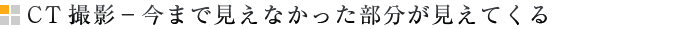 CT撮影－今まで見えなかった部分が見えてくる