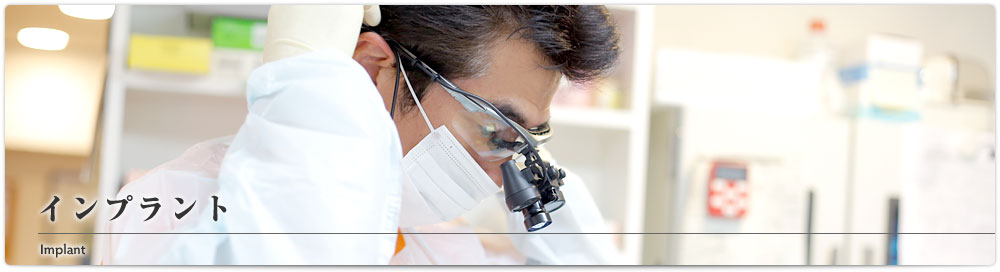 インプラント
