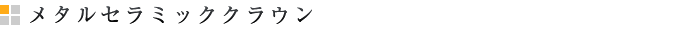 メタルセラミッククラウン